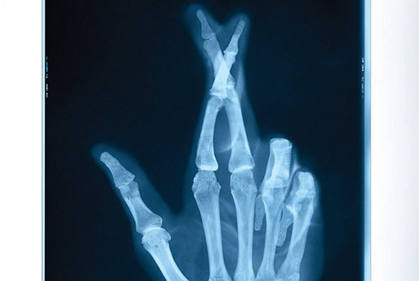 United Health Care | Fingers Crossed